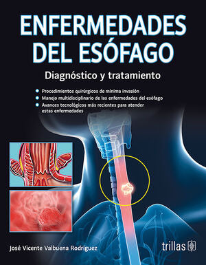 ENFERMEDADES DEL ESOFAGO | VALBUENA RODRIGUEZ, JOSE VICENTE | Trillas