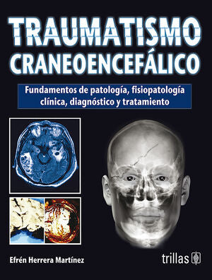 TRAUMATISMO CRANEOENCEFALICO | HERRERA MARTINEZ, EFREN | Trillas