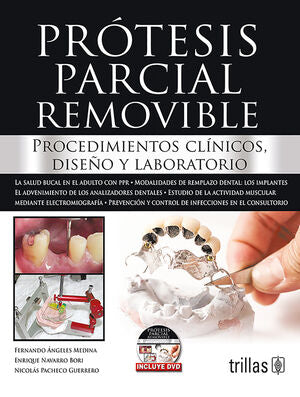 PROTESIS PARCIAL REMOVIBLE | ANGELES MEDINA, FERNANDO; NAVARRO BORI, ENRIQUE; PACHECO GUERRERO, NICOLAS | Trillas