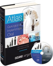 Atlas Quirúrgico de Implantología Oral [Hardcover] Océano