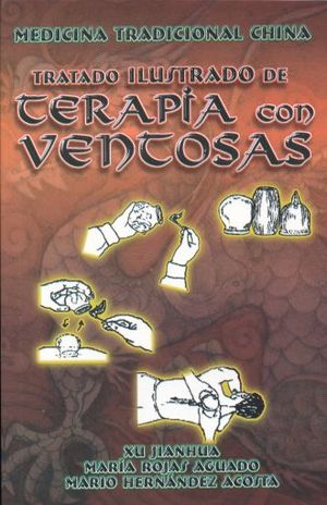 Tratado Ilustrado De Terapia Con Ventosas