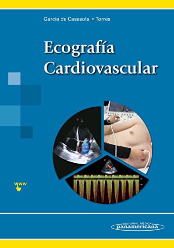 Ecografía Cardiovascular [Paperback] García De Casasola Sánchez, Gonzalo and Torres Macho, Juan